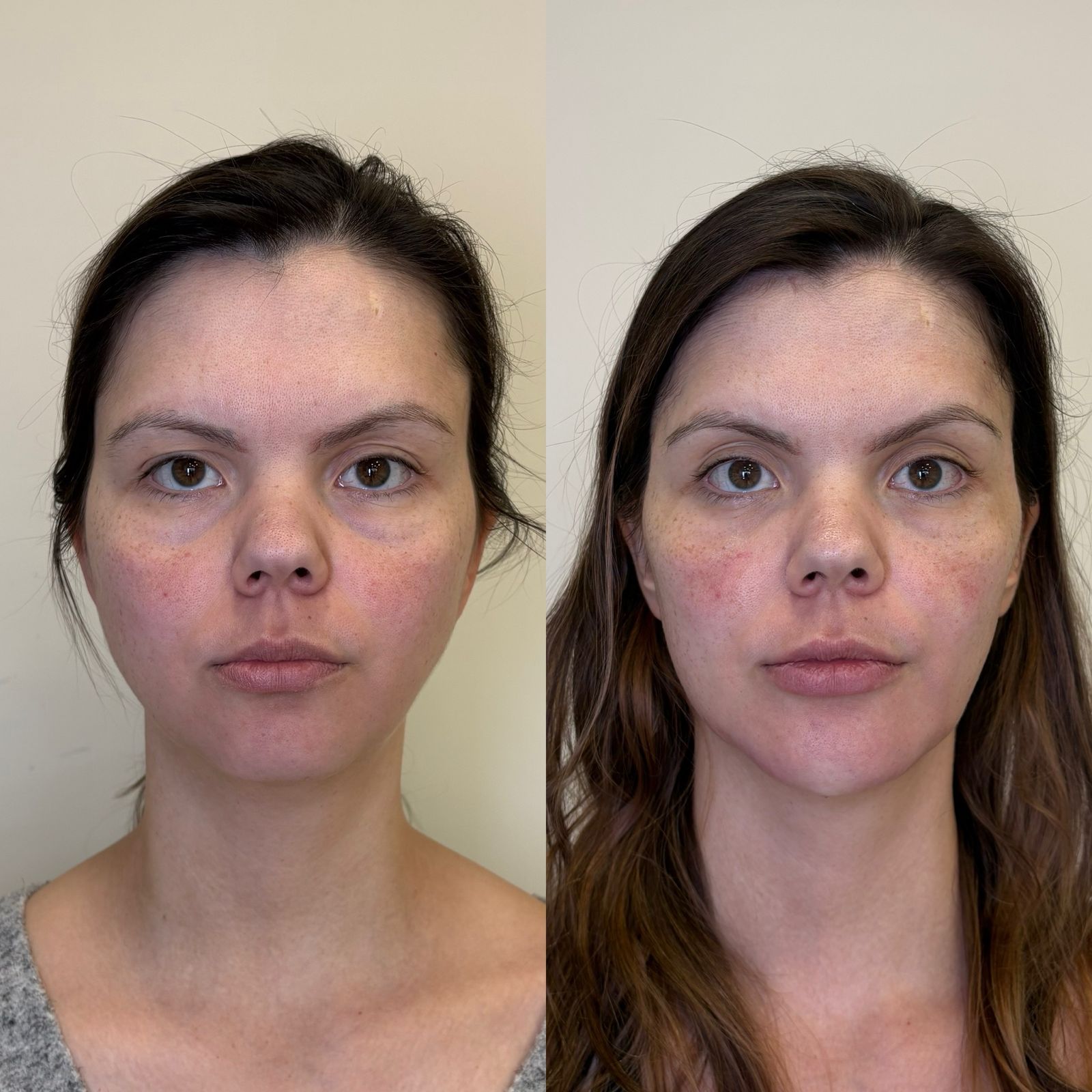 Antes e depois
